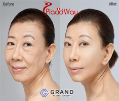 Slider image (3) Grand Plastic Surgery